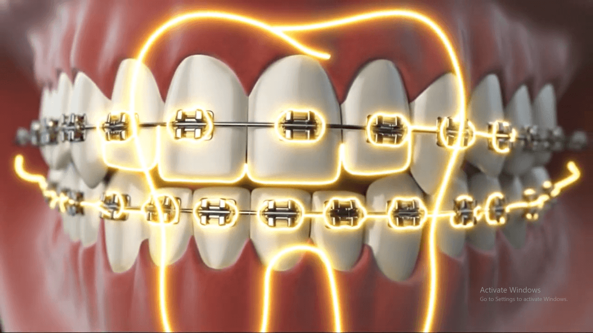 Dental Clinic Motion Graphics - 2